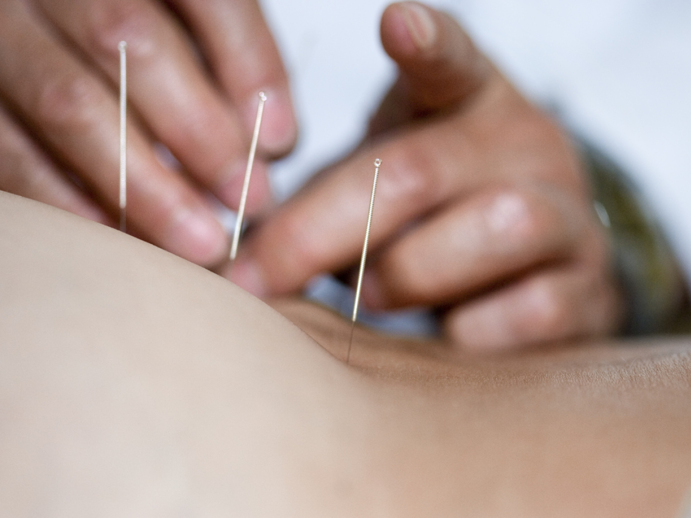 Acupuncture and homeopathy will continue to be reimbursed